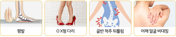 평발, O X형 다리, 골반 척추 뒤틀림, 어깨 얼굴 비대칭, 본원에서는 턱 및 체형교정을 실시하고 있습니다. 